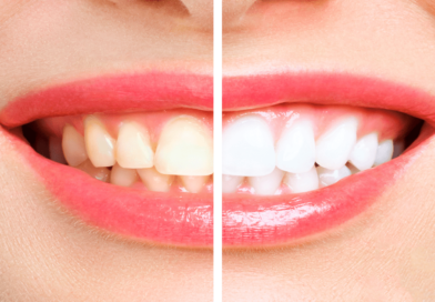 Depositphotos 308410356 Xl