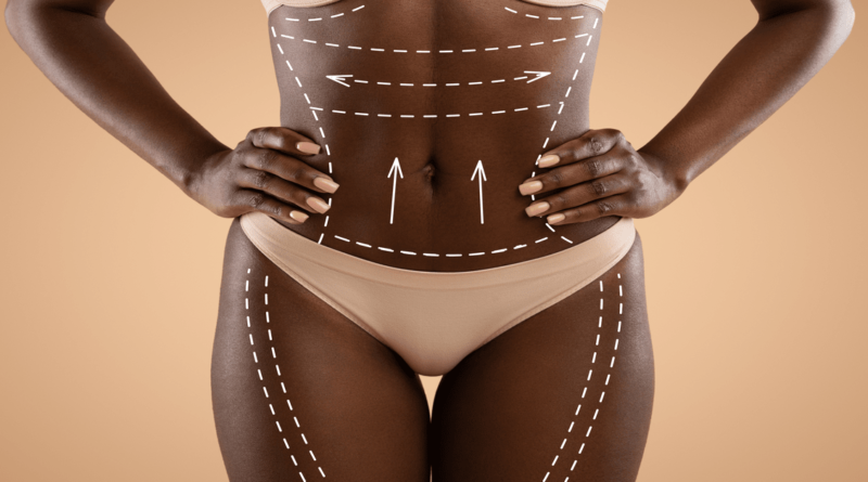 Depositphotos 564253482 Xl